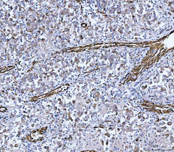 PTRF/CAVIN1 Antibody