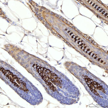 Cytokeratin 1/Krt1 Rabbit Polyclonal Antibody