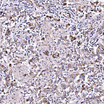 RAB3GAP1 Antibody