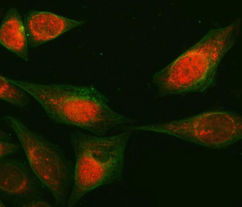 RAB3GAP1 Antibody