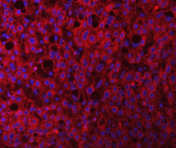 RAB3GAP1 Antibody