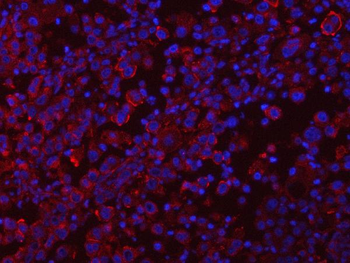 RAB3GAP1 Antibody