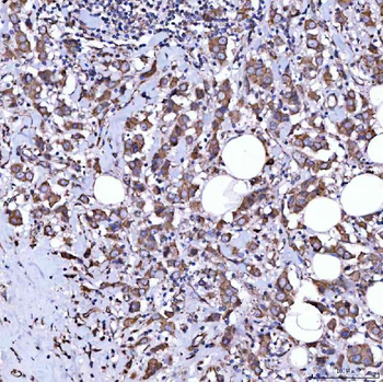 RAB3GAP1 Antibody
