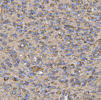 RAB3GAP1 Antibody