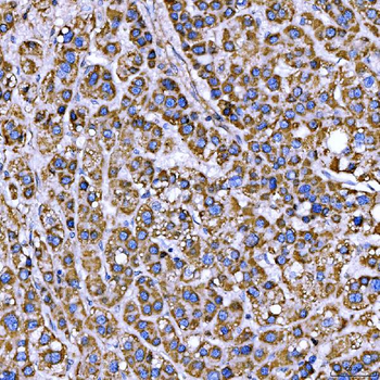 RAB3GAP1 Antibody