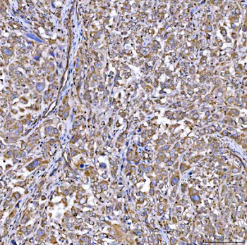 RAB3GAP1 Antibody