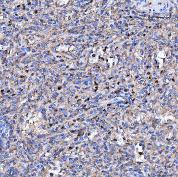 RAB3GAP1 Antibody