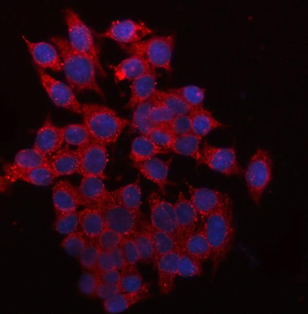 QPRT Rabbit Polyclonal Antibody