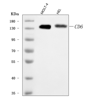 T12/CD6 Rabbit Polyclonal Antibody