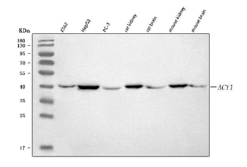 ACY-1/ACY1/ACY Rabbit Polyclonal Antibody