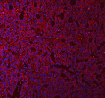 QARS1 Rabbit Polyclonal Antibody