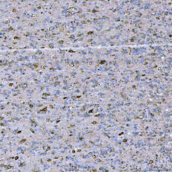 STAP2 Rabbit Polyclonal Antibody