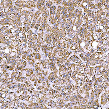 STAP2 Rabbit Polyclonal Antibody