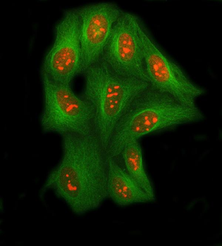 SSRP1 Antibody