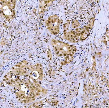 SSRP1 Antibody