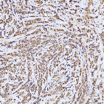 SSRP1 Antibody