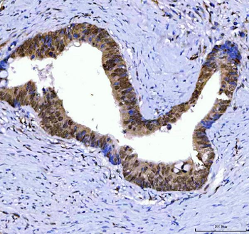SSRP1 Antibody