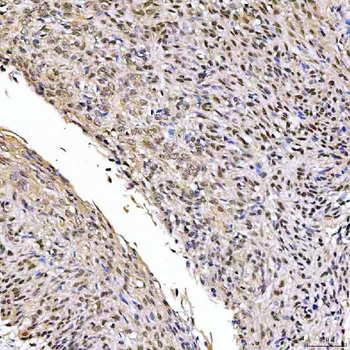 SSRP1 Antibody