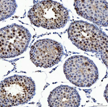 SSRP1 Antibody