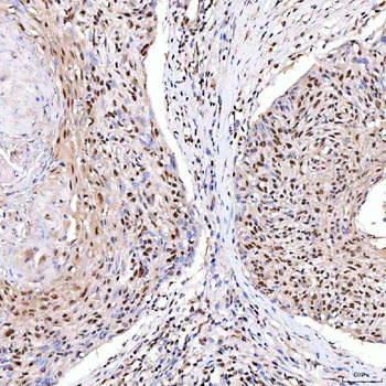 ARS2/SRRT Antibody