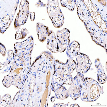 ARS2/SRRT Antibody