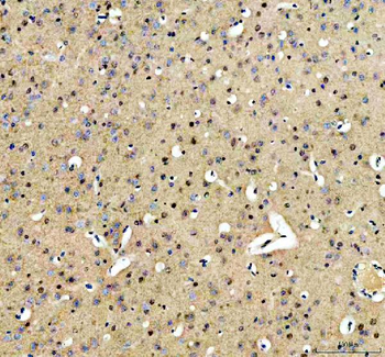 ARS2/SRRT Antibody