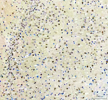 ARS2/SRRT Antibody