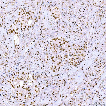 ARS2/SRRT Antibody