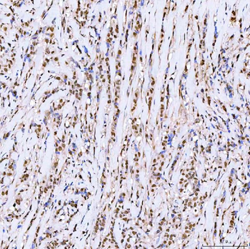 ARS2/SRRT Antibody