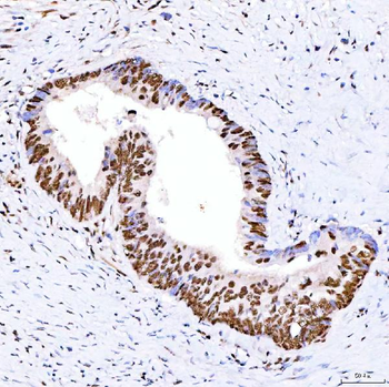 ARS2/SRRT Antibody
