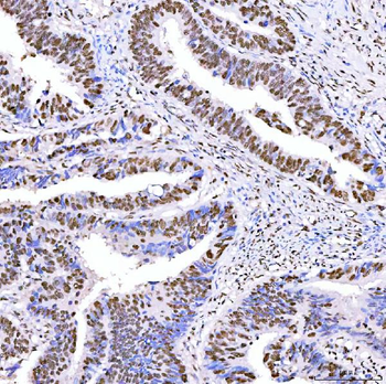 ARS2/SRRT Antibody