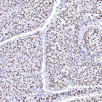 ARS2/SRRT Antibody