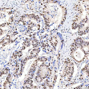ARS2/SRRT Antibody