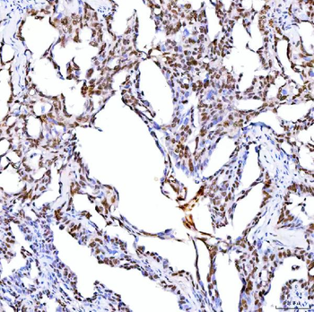 ARS2/SRRT Antibody