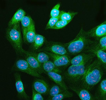 WDR36 Rabbit Polyclonal Antibody