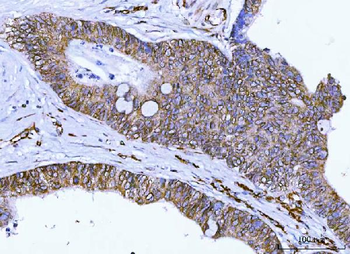 Nesprin 2/SYNE2 Antibody