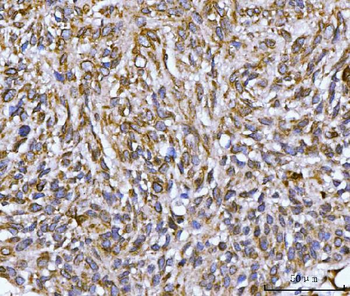 Nesprin 2/SYNE2 Antibody
