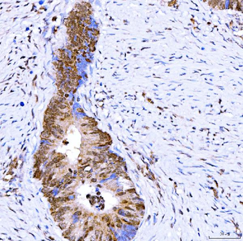 Symplekin/SYMPK Antibody