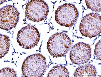 Symplekin/SYMPK Antibody