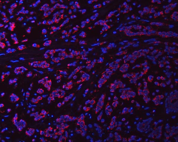 Syntaxin 18/STX18 Antibody