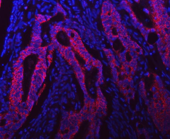 Syntaxin 18/STX18 Antibody