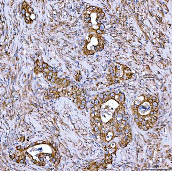 Syntaxin 18/STX18 Antibody