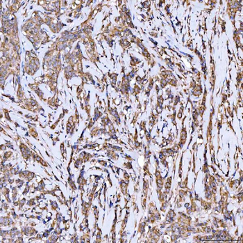 Syntaxin 18/STX18 Antibody