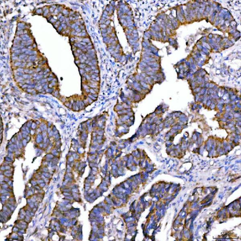 Syntaxin 18/STX18 Antibody