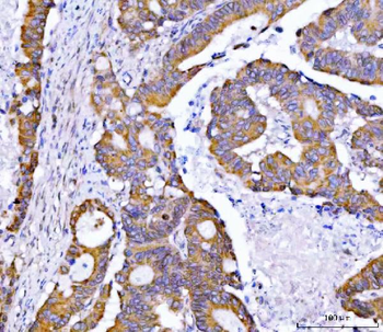 Syntaxin 18/STX18 Antibody