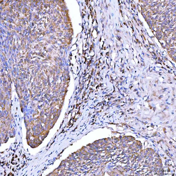 Syntaxin 18/STX18 Antibody