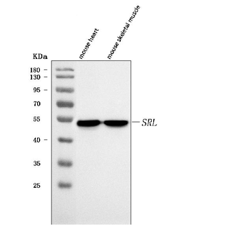 Sarcalumenin/Srl Rabbit Polyclonal Antibody