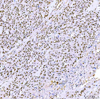 SA2/STAG2 Antibody