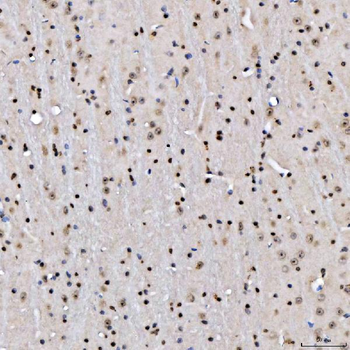 SA2/STAG2 Antibody