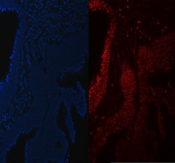 SA2/STAG2 Antibody